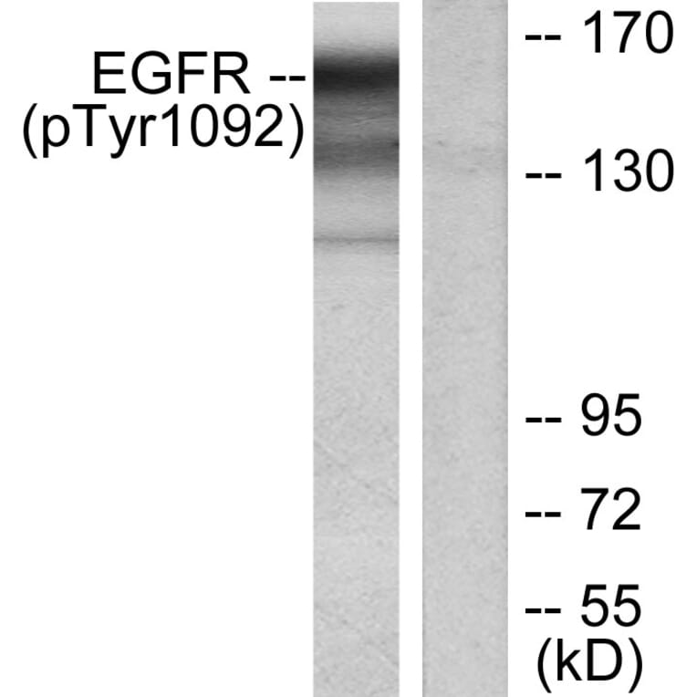 Western Blot - Anti-EGFR (phospho Tyr1092) Antibody (A7061) - Antibodies.com