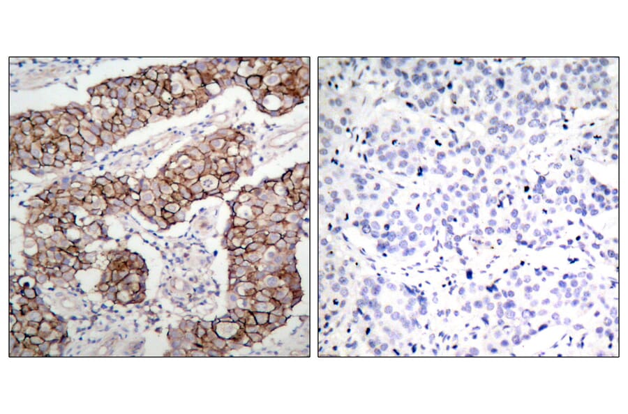 Immunohistochemistry - Anti-EGFR (phospho Tyr1092) Antibody (A7061) - Antibodies.com