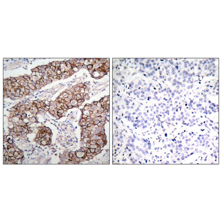Immunohistochemistry - Anti-EGFR (phospho Tyr1092) Antibody (A7061) - Antibodies.com