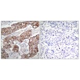 Immunohistochemistry - Anti-EGFR (phospho Tyr1092) Antibody (A7061) - Antibodies.com