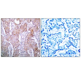 Immunohistochemistry - Anti-EGFR (phospho Ser1070) Antibody (A7060) - Antibodies.com