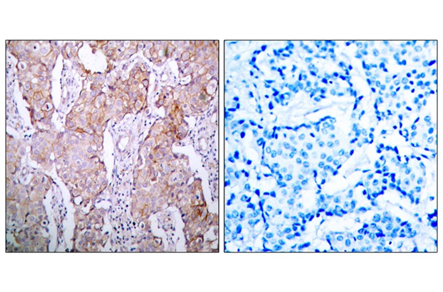 Immunohistochemistry - Anti-EGFR (phospho Ser1070) Antibody (A7060) - Antibodies.com