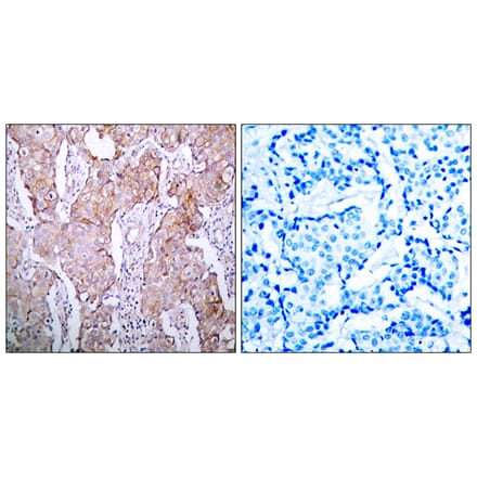Immunohistochemistry - Anti-EGFR (phospho Ser1070) Antibody (A7060) - Antibodies.com