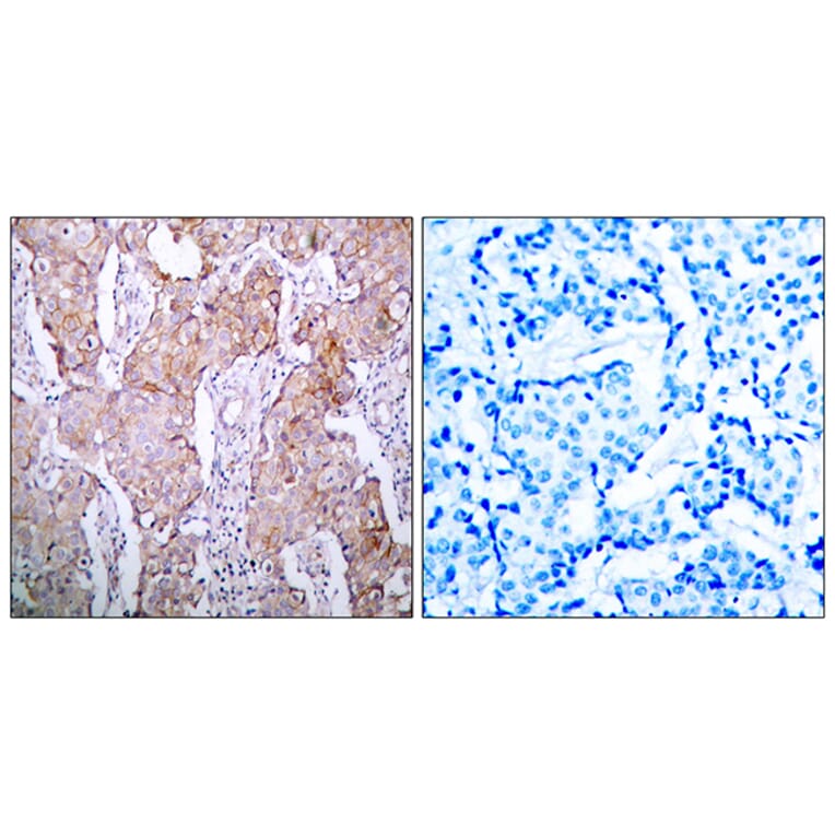Immunohistochemistry - Anti-EGFR (phospho Ser1070) Antibody (A7060) - Antibodies.com