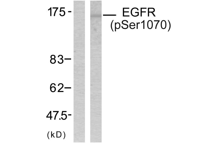 Western Blot - Anti-EGFR (phospho Ser1070) Antibody (A7060) - Antibodies.com