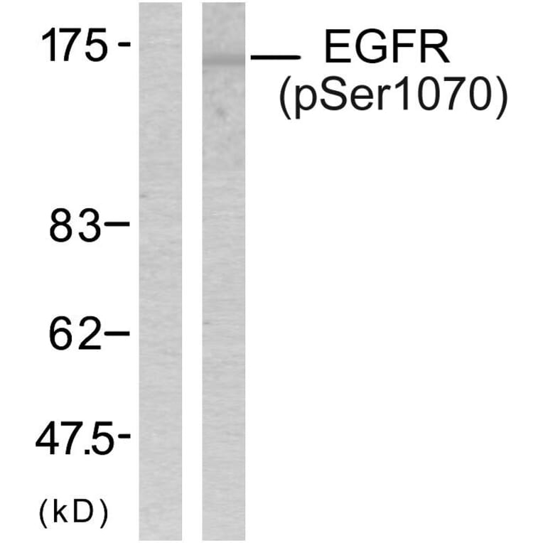 Western Blot - Anti-EGFR (phospho Ser1070) Antibody (A7060) - Antibodies.com