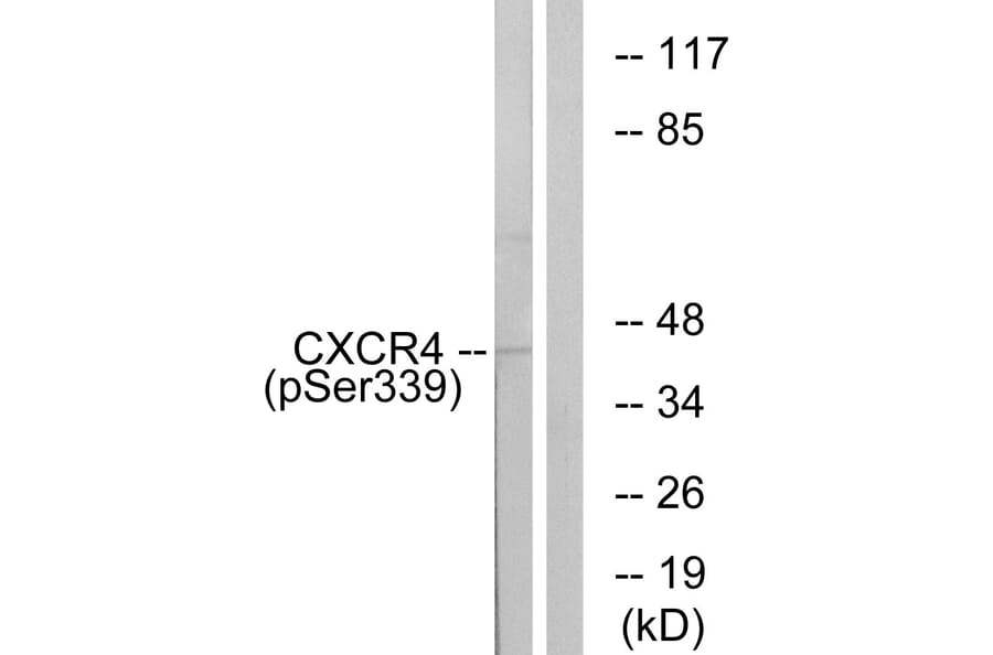 Western Blot - Anti-CXCR4 (phospho Ser339) Antibody (A0878) - Antibodies.com