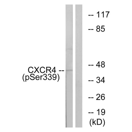 Western Blot - Anti-CXCR4 (phospho Ser339) Antibody (A0878) - Antibodies.com
