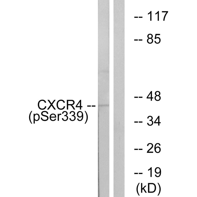 Western Blot - Anti-CXCR4 (phospho Ser339) Antibody (A0878) - Antibodies.com