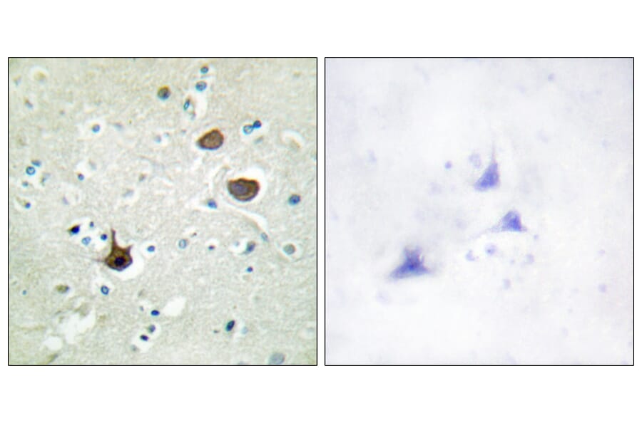 Immunohistochemistry - Anti-CXCR4 (phospho Ser339) Antibody (A0878) - Antibodies.com