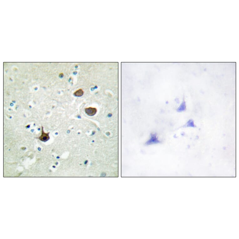 Immunohistochemistry - Anti-CXCR4 (phospho Ser339) Antibody (A0878) - Antibodies.com