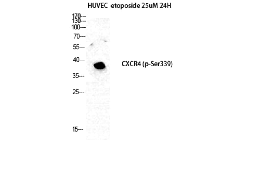 Western Blot - Anti-CXCR4 (phospho Ser339) Antibody (A0878) - Antibodies.com