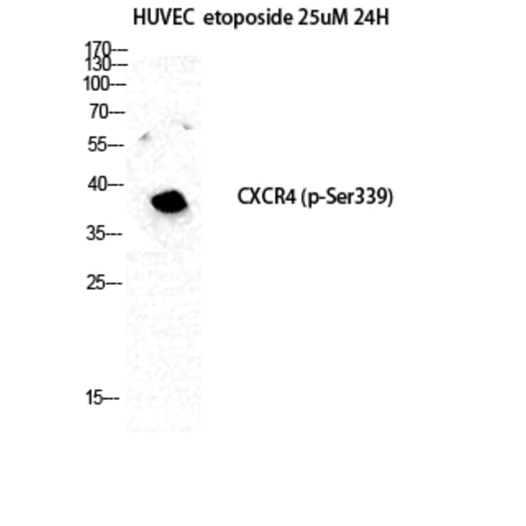 Western Blot - Anti-CXCR4 (phospho Ser339) Antibody (A0878) - Antibodies.com