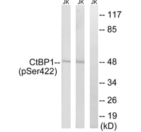 Western Blot - Anti-CtBP1 (phospho Ser422) Antibody (A8325) - Antibodies.com