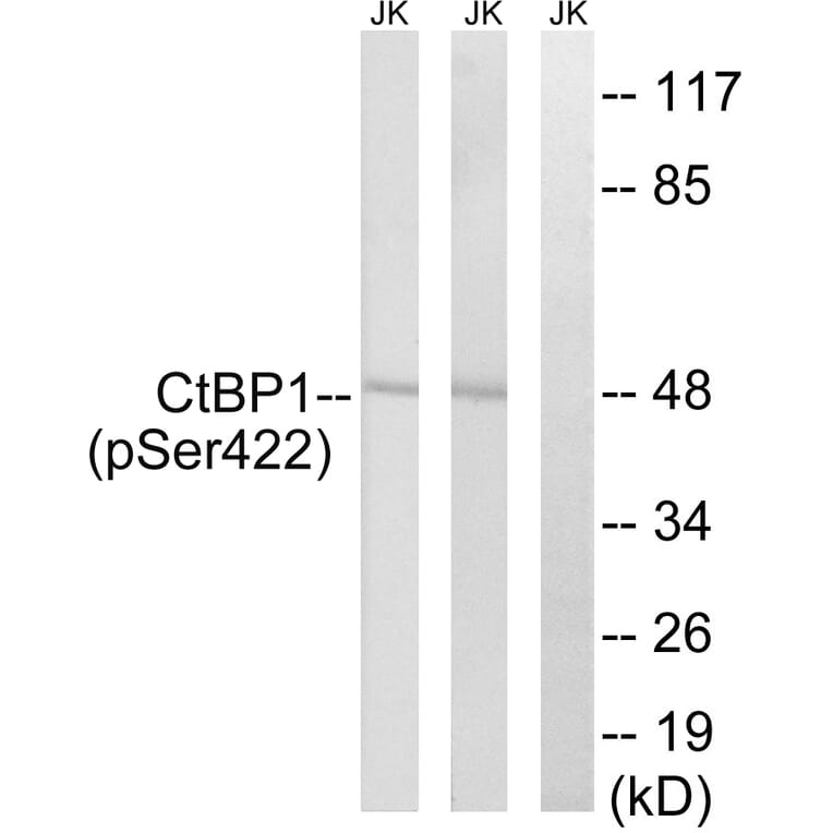 Western Blot - Anti-CtBP1 (phospho Ser422) Antibody (A8325) - Antibodies.com