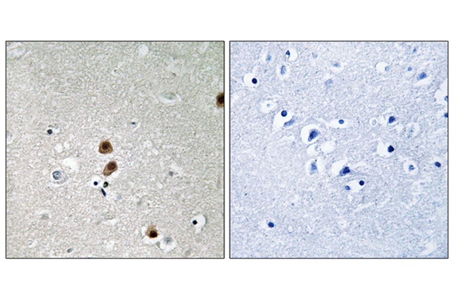 Immunohistochemistry - Anti-CtBP1 (phospho Ser422) Antibody (A8325) - Antibodies.com