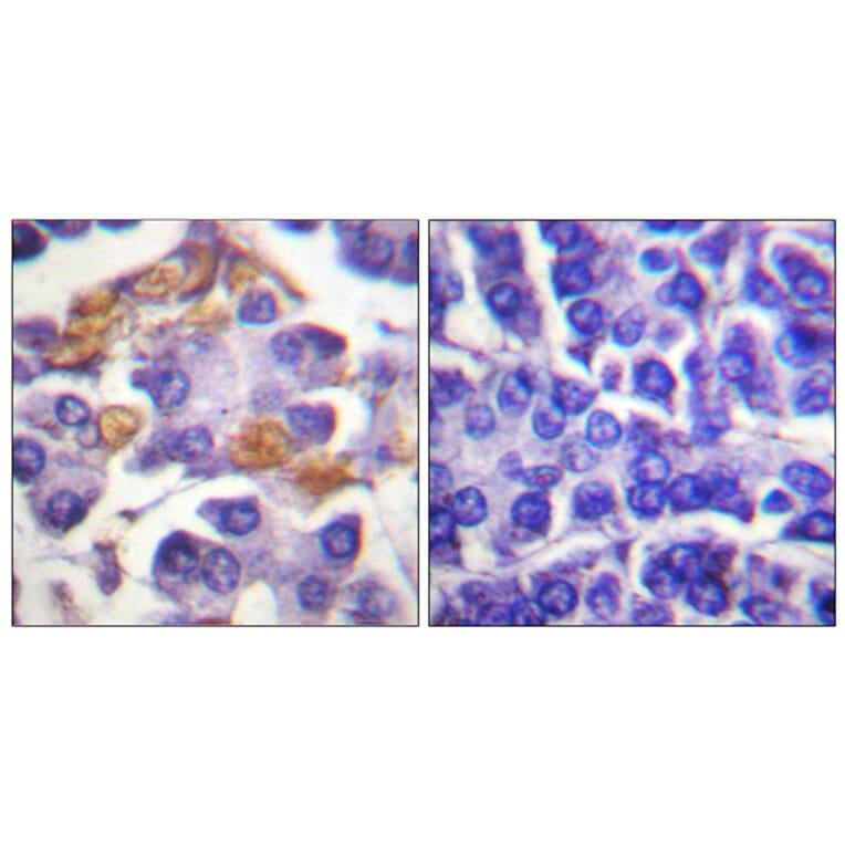 Immunohistochemistry - Anti-C-RAF (phospho Tyr341) Antibody (A0565) - Antibodies.com