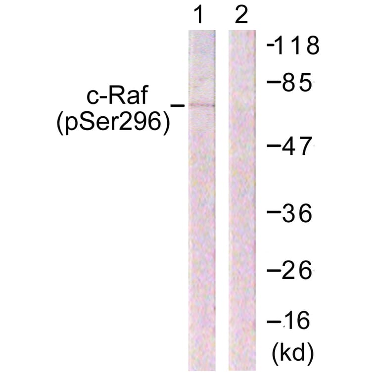 Western Blot - Anti-C-RAF (phospho Ser296) Antibody (A0634) - Antibodies.com