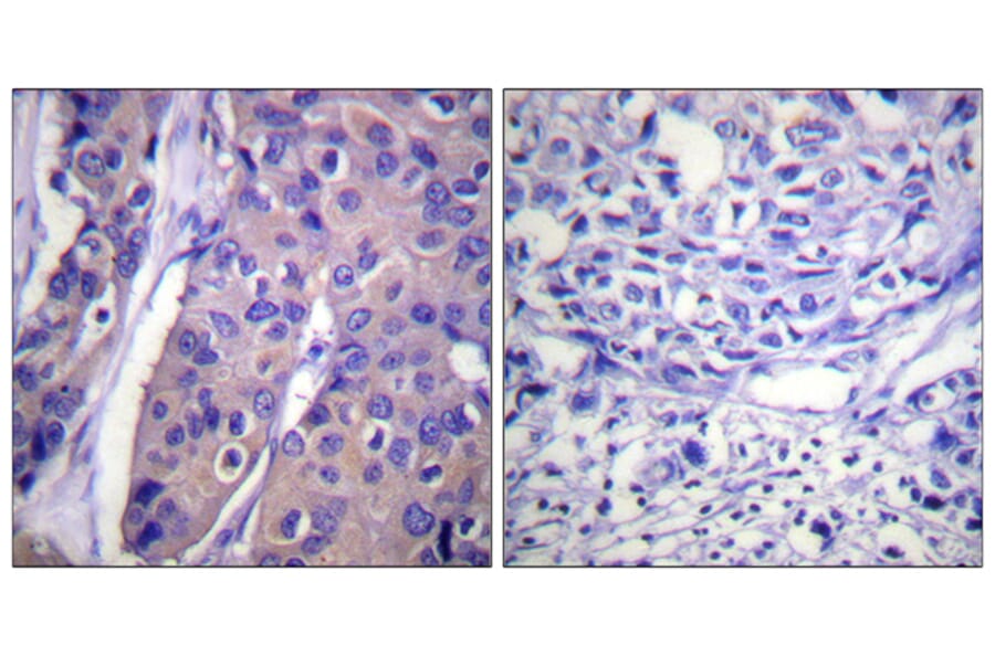 Immunohistochemistry - Anti-C-RAF (phospho Ser296) Antibody (A0634) - Antibodies.com