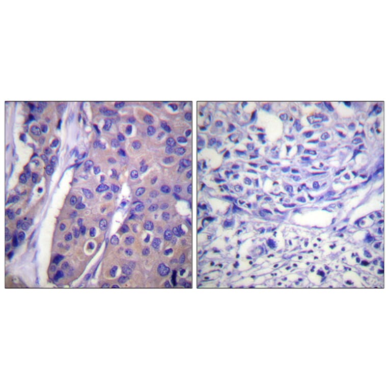 Immunohistochemistry - Anti-C-RAF (phospho Ser296) Antibody (A0634) - Antibodies.com