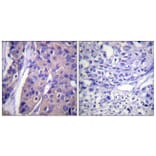 Immunohistochemistry - Anti-C-RAF (phospho Ser296) Antibody (A0634) - Antibodies.com