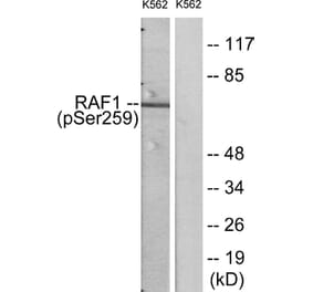 Western Blot - Anti-C-RAF (phospho Ser259) Antibody (A7206) - Antibodies.com