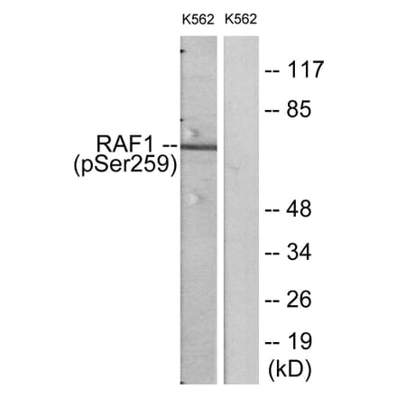 Western Blot - Anti-C-RAF (phospho Ser259) Antibody (A7206) - Antibodies.com