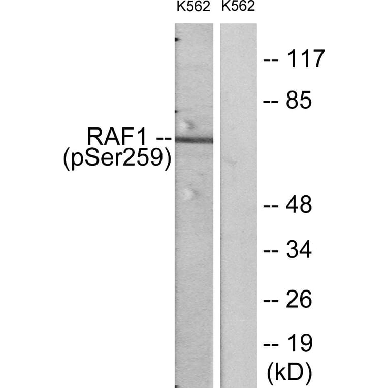 Western Blot - Anti-C-RAF (phospho Ser259) Antibody (A7206) - Antibodies.com