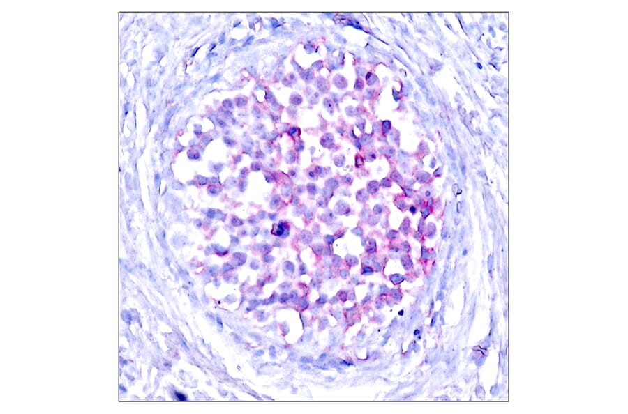 Immunohistochemistry - Anti-C-RAF (phospho Ser259) Antibody (A7206) - Antibodies.com