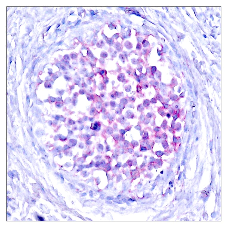 Immunohistochemistry - Anti-C-RAF (phospho Ser259) Antibody (A7206) - Antibodies.com