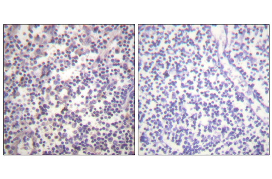 Immunohistochemistry - Anti-B-RAF (phospho Ser602) Antibody (A0781) - Antibodies.com
