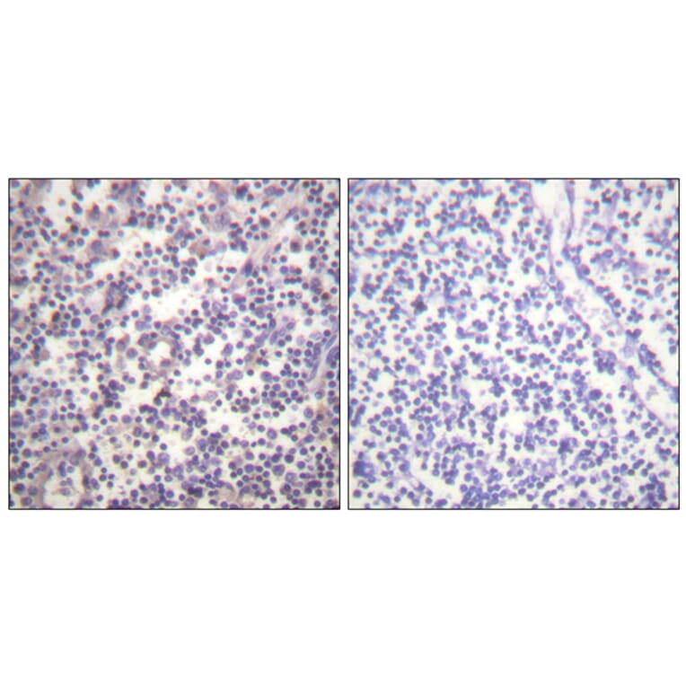 Immunohistochemistry - Anti-B-RAF (phospho Ser602) Antibody (A0781) - Antibodies.com