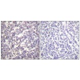 Immunohistochemistry - Anti-B-RAF (phospho Ser602) Antibody (A0781) - Antibodies.com