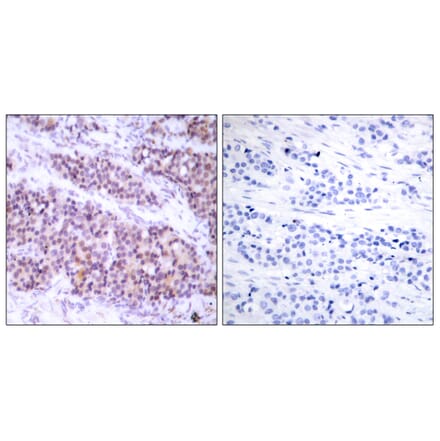 Immunohistochemistry - Anti-BCL-XL (phospho Ser62) Antibody (A7027) - Antibodies.com