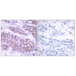 Immunohistochemistry - Anti-BCL-XL (phospho Ser62) Antibody (A7027) - Antibodies.com