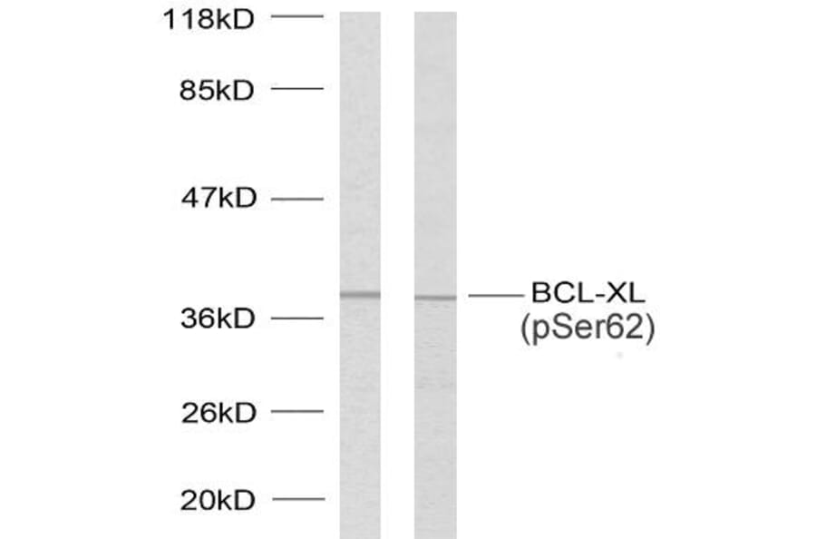 Western Blot - Anti-BCL-XL (phospho Ser62) Antibody (A7027) - Antibodies.com