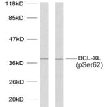 Western Blot - Anti-BCL-XL (phospho Ser62) Antibody (A7027) - Antibodies.com