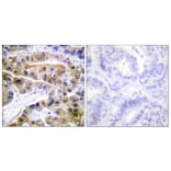 Immunohistochemistry - Anti-ATPase (phospho Ser16) Antibody (A0458) - Antibodies.com