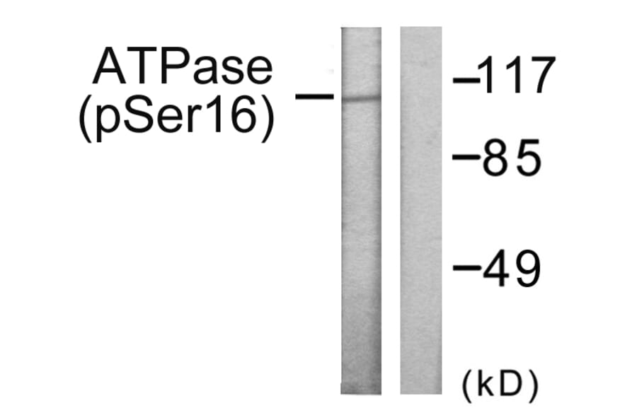Western Blot - Anti-ATPase (phospho Ser16) Antibody (A0458) - Antibodies.com