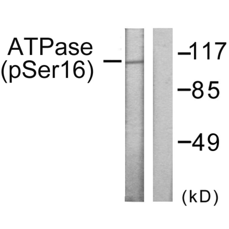 Western Blot - Anti-ATPase (phospho Ser16) Antibody (A0458) - Antibodies.com