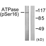 Western Blot - Anti-ATPase (phospho Ser16) Antibody (A0458) - Antibodies.com