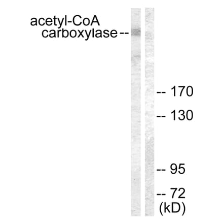 Western Blot - Anti-acetyl CoA Carboxylase Antibody (B0051) - Antibodies.com