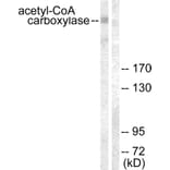 Western Blot - Anti-acetyl CoA Carboxylase Antibody (B0051) - Antibodies.com