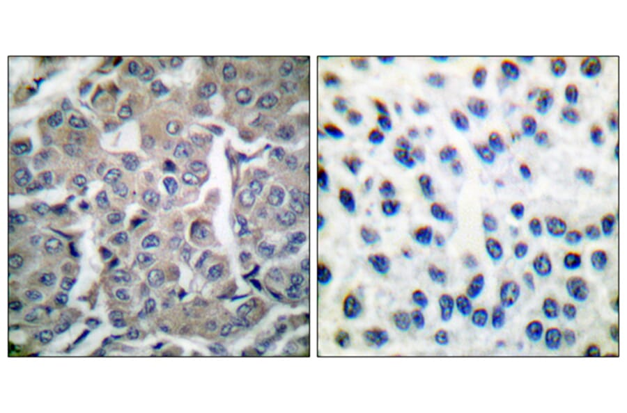 Immunohistochemistry - Anti-acetyl CoA Carboxylase Antibody (B0051) - Antibodies.com