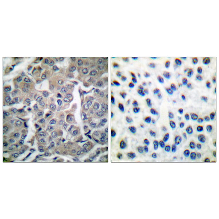 Immunohistochemistry - Anti-acetyl CoA Carboxylase Antibody (B0051) - Antibodies.com