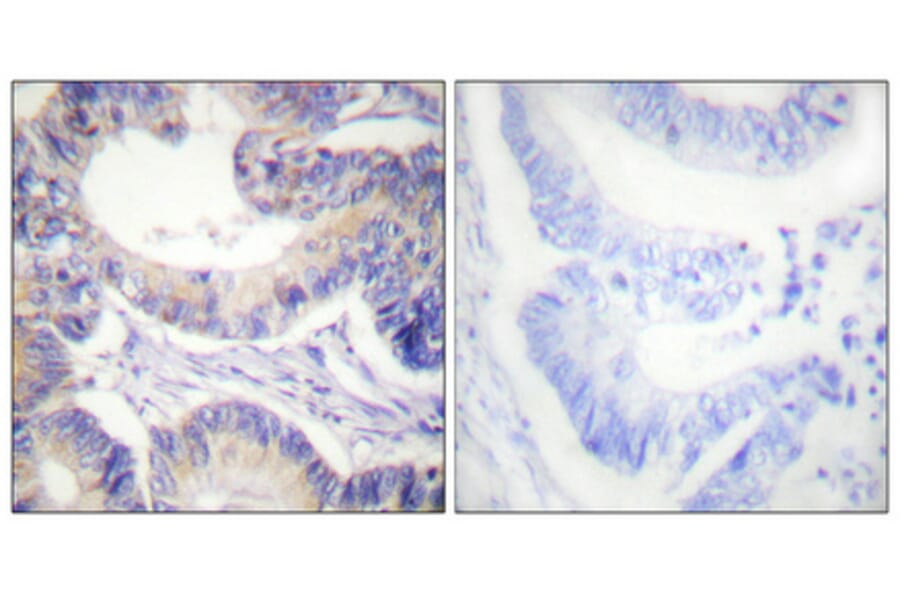 Immunohistochemistry - Anti-acetyl CoA Carboxylase Antibody (B0051) - Antibodies.com