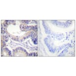 Immunohistochemistry - Anti-acetyl CoA Carboxylase Antibody (B0051) - Antibodies.com