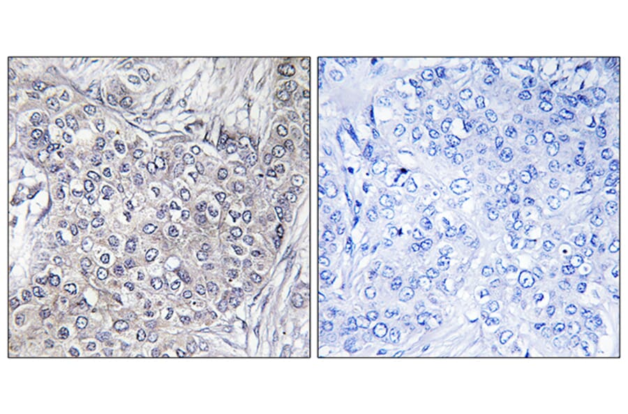 Immunohistochemistry - Anti-4E-BP1 (phospho Thr45) Antibody (A7002) - Antibodies.com