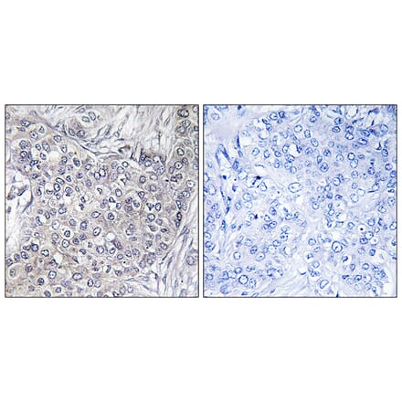 Immunohistochemistry - Anti-4E-BP1 (phospho Thr45) Antibody (A7002) - Antibodies.com
