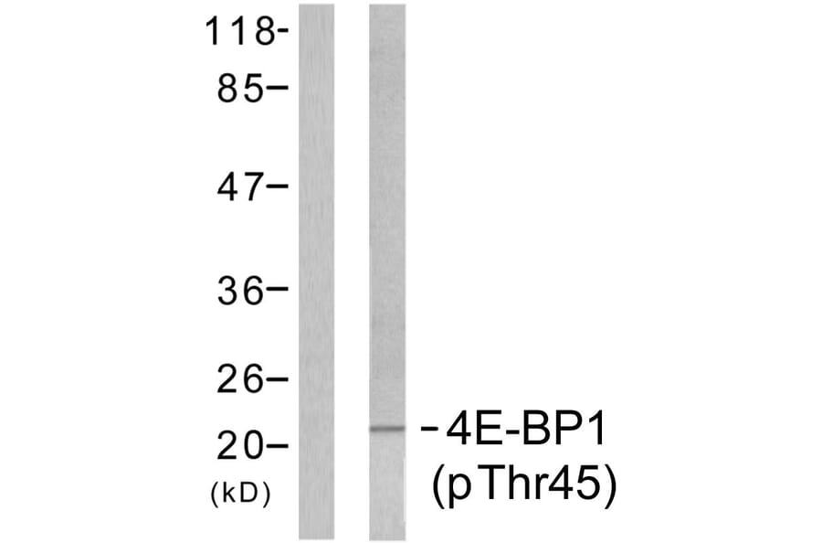 Western Blot - Anti-4E-BP1 (phospho Thr45) Antibody (A7002) - Antibodies.com